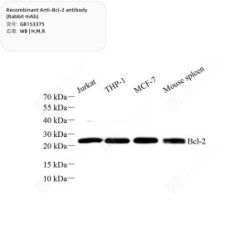 Recombinant Anti-Bcl-2 antibody (Rabbit mAb)