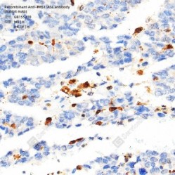 Recombinant Anti-TMS1/ASC antibody (Rabbit mAb)
