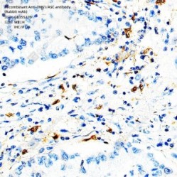 Recombinant Anti-TMS1/ASC antibody (Rabbit mAb)