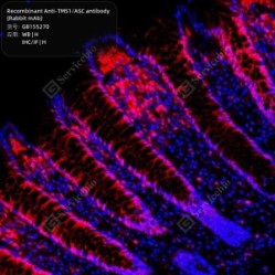 Recombinant Anti-TMS1/ASC antibody (Rabbit mAb)