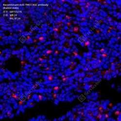 Recombinant Anti-TMS1/ASC antibody (Rabbit mAb)