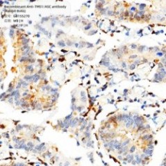 Recombinant Anti-TMS1/ASC...