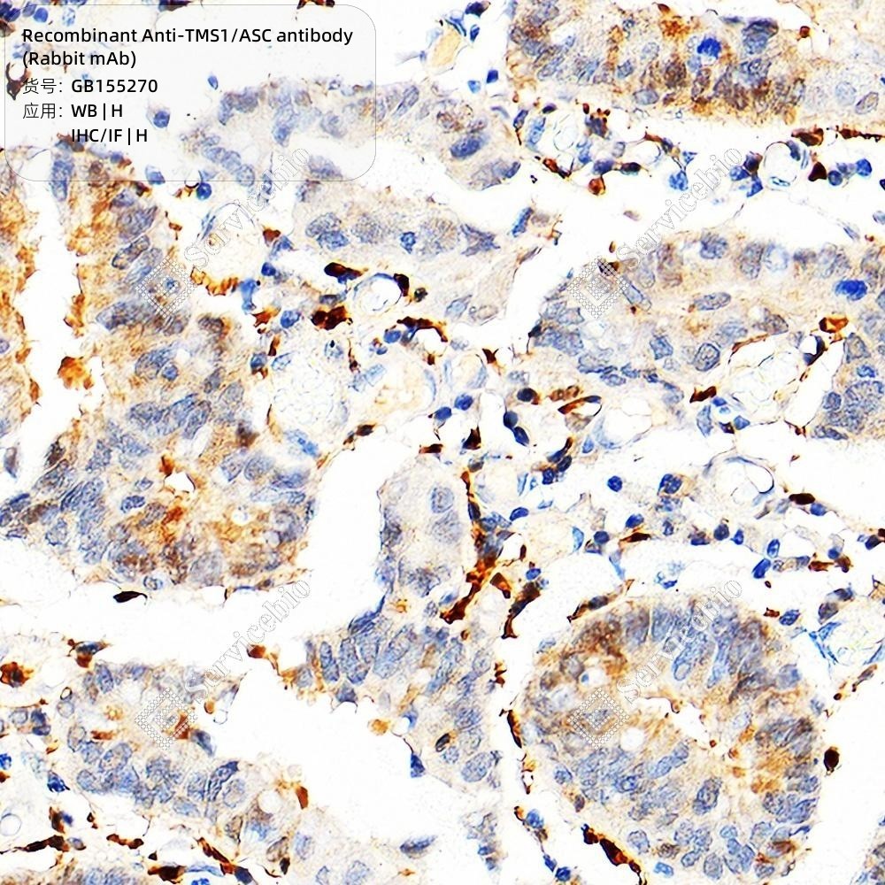 Recombinant Anti-TMS1/ASC antibody (Rabbit mAb)