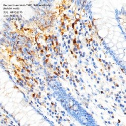 Recombinant Anti-TMS1/ASC antibody (Rabbit mAb)
