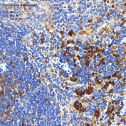 Anti-Caspase-3 Mouse mAb