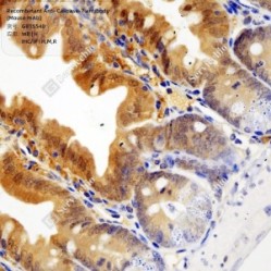 Recombinant Anti-Caspase-7 antibody (Mouse mAb)