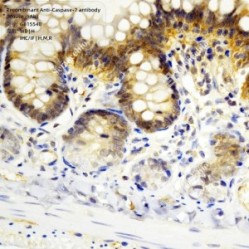 Recombinant Anti-Caspase-7 antibody (Mouse mAb)