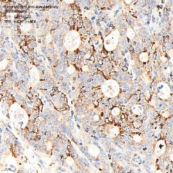 Recombinant Anti-Bax antibody (Rabbit mAb)