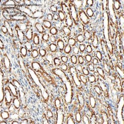 Recombinant Anti-Bax antibody (Rabbit mAb)