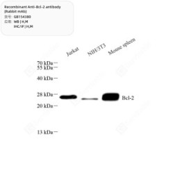 Recombinant Anti-Bcl-2 antibody (Rabbit mAb)