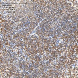 Recombinant Anti-Bcl-2 antibody (Rabbit mAb)