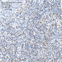 Recombinant Anti-Bcl-2 antibody (Rabbit mAb)