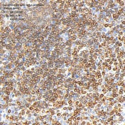 Recombinant Anti-Bcl-2 antibody (Rabbit mAb)