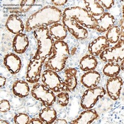 Recombinant Anti-Bax antibody (Rabbit mAb)