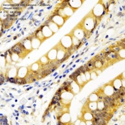 Recombinant Anti-Caspase-7 antibody (Mouse mAb)