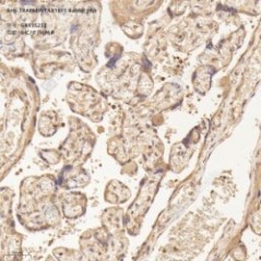 Anti-TRAF6BP/TAX1BP1 Rabbit...