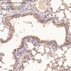Anti-TRAF6BP/TAX1BP1 Rabbit pAb