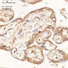 Anti-IKIP Rabbit pAb