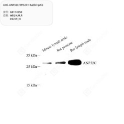 Anti-ANP32C/PP32R1 Rabbit pAb