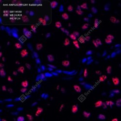 Anti-ANP32C/PP32R1 Rabbit pAb