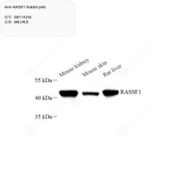 Anti-RASSF1 Rabbit pAb