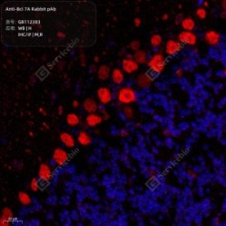 Anti-Bcl 7A Rabbit pAb