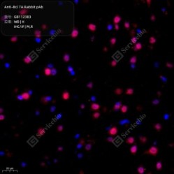 Anti-Bcl 7A Rabbit pAb