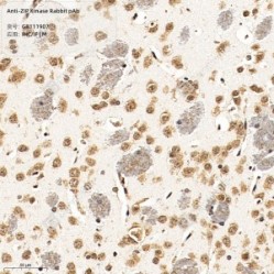 Anti-ZIP Kinase Rabbit pAb
