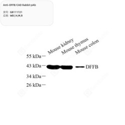 Anti-DFFB/CAD Rabbit pAb