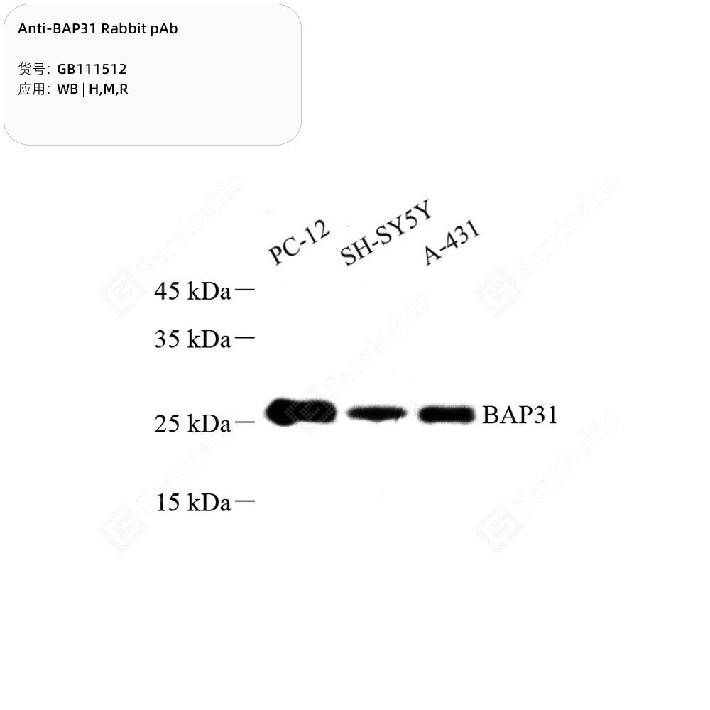 Anti-BAP31 Rabbit pAb