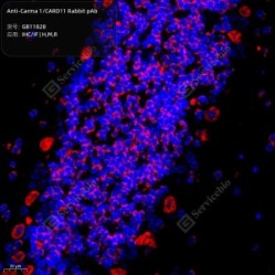 Anti-Carma 1/CARD11 Rabbit pAb
