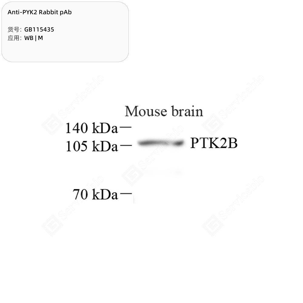 Anti-PYK2 Rabbit pAb