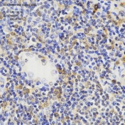 Anti-TMS1/ASC Rabbit pAb