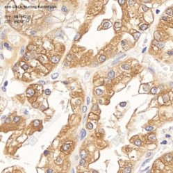 Anti-UACA/Nucling Rabbit pAb