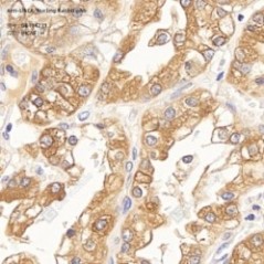 Anti-UACA/Nucling Rabbit pAb
