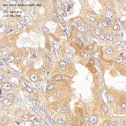Anti-UACA/Nucling Rabbit pAb