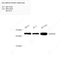 Anti-ANP32C/PP32R1 Rabbit pAb