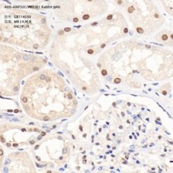 Anti-ANP32C/PP32R1 Rabbit pAb