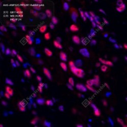 Anti-ANP32C/PP32R1 Rabbit pAb