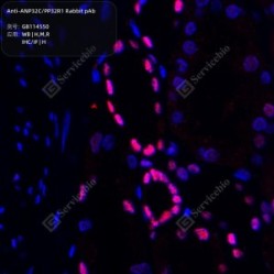 Anti-ANP32C/PP32R1 Rabbit pAb