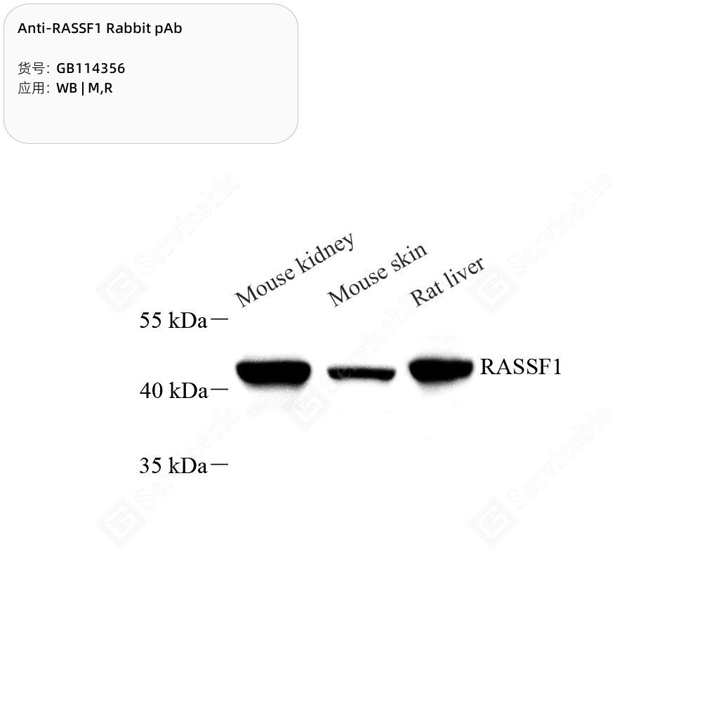 Anti-RASSF1 Rabbit pAb