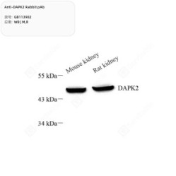 Anti-DAPK2 Rabbit pAb