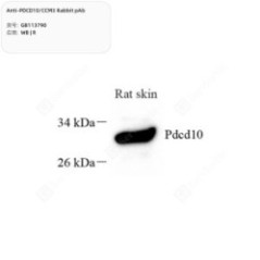 Anti-PDCD10/CCM3 Rabbit pAb