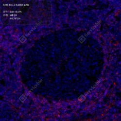 Anti-Bcl-2 Rabbit pAb