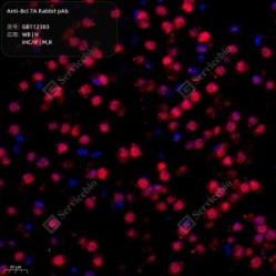 Anti-Bcl 7A Rabbit pAb