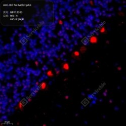 Anti-Bcl 7A Rabbit pAb