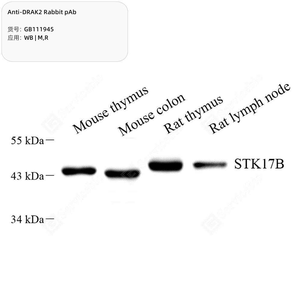 Anti-DRAK2 Rabbit pAb