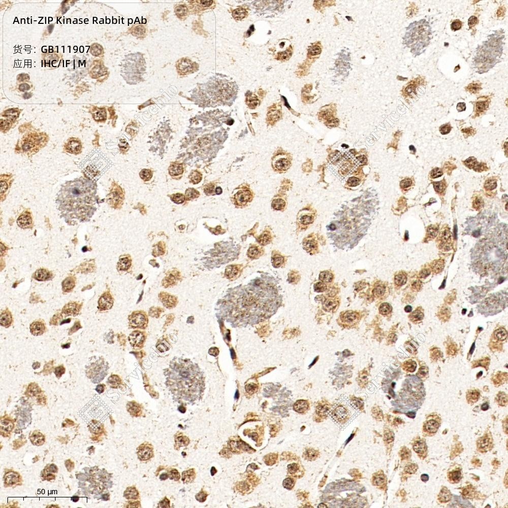 Anti-ZIP Kinase Rabbit pAb