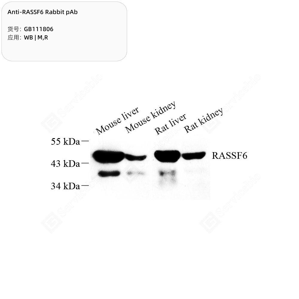 Anti-RASSF6 Rabbit pAb
