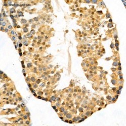 Anti-BNIP3 Rabbit pAb